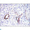 Disks large-associated protein 1 antibody, LS-C812765, Lifespan Biosciences, Immunohistochemistry paraffin image 