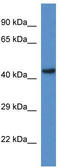 Glutaryl-CoA Dehydrogenase antibody, TA331987, Origene, Western Blot image 