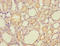 Hydroxyacylglutathione Hydrolase antibody, A51970-100, Epigentek, Immunohistochemistry paraffin image 