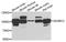 Disintegrin and metalloproteinase domain-containing protein 12 antibody, A7940, ABclonal Technology, Western Blot image 
