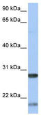Brain Derived Neurotrophic Factor antibody, TA346304, Origene, Western Blot image 