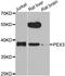 Peroxisomal Biogenesis Factor 3 antibody, STJ29491, St John