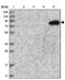 TatD DNase Domain Containing 2 antibody, NBP1-93652, Novus Biologicals, Western Blot image 
