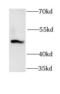 Glycogen Synthase Kinase 3 Alpha antibody, FNab03672, FineTest, Western Blot image 