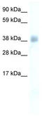 YY1 Transcription Factor antibody, TA330125, Origene, Western Blot image 