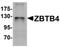 Zinc finger and BTB domain-containing protein 4 antibody, orb75549, Biorbyt, Western Blot image 
