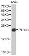 Parathyroid Hormone Like Hormone antibody, MBS127724, MyBioSource, Western Blot image 