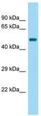 BEN Domain Containing 5 antibody, TA337986, Origene, Western Blot image 
