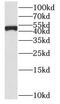 Succinate-CoA Ligase GDP-Forming Beta Subunit antibody, FNab08371, FineTest, Western Blot image 