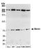 Menin 1 antibody, A500-003A, Bethyl Labs, Western Blot image 