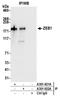 Zinc Finger E-Box Binding Homeobox 1 antibody, A301-922A, Bethyl Labs, Immunoprecipitation image 