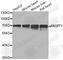Angiopoietin 1 antibody, A7413, ABclonal Technology, Western Blot image 