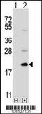 Ubiquitin-fold modifier-conjugating enzyme 1 antibody, 61-140, ProSci, Western Blot image 