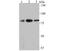 VPS35 Retromer Complex Component antibody, A01644-1, Boster Biological Technology, Western Blot image 