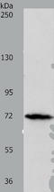 Spleen Associated Tyrosine Kinase antibody, TA323858, Origene, Western Blot image 