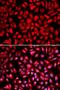 Importin-5 antibody, LS-C331805, Lifespan Biosciences, Immunofluorescence image 