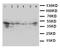 Cellular Communication Network Factor 4 antibody, LS-C313208, Lifespan Biosciences, Western Blot image 