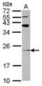 ADP Ribosylation Factor Like GTPase 8B antibody, LS-C155630, Lifespan Biosciences, Western Blot image 