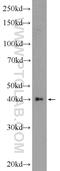 Adenylate Kinase 9 antibody, 23042-1-AP, Proteintech Group, Western Blot image 