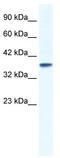Potassium channel subfamily K member 3 antibody, TA338524, Origene, Western Blot image 