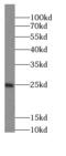 Integrin Subunit Beta 3 Binding Protein antibody, FNab01595, FineTest, Western Blot image 