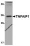 TNF Alpha Induced Protein 1 antibody, 8345, ProSci, Western Blot image 