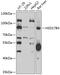 Hydroxysteroid 17-Beta Dehydrogenase 4 antibody, GTX55666, GeneTex, Western Blot image 
