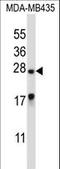 Male-Enhanced Antigen 1 antibody, LS-C158120, Lifespan Biosciences, Western Blot image 