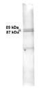 Inner Membrane Mitochondrial Protein antibody, NB100-1919, Novus Biologicals, Western Blot image 