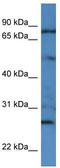 Golgin A1 antibody, TA335043, Origene, Western Blot image 