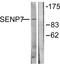Sentrin-specific protease 7 antibody, LS-C118617, Lifespan Biosciences, Western Blot image 