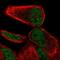NHL Repeat Containing 2 antibody, PA5-66090, Invitrogen Antibodies, Immunofluorescence image 