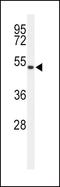 Hydroxyindole O-methyltransferase antibody, PA5-24721, Invitrogen Antibodies, Western Blot image 