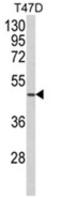 Putative neutrophil cytosol factor 1C antibody, AP18124PU-N, Origene, Western Blot image 