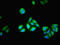 Phosphoglucomutase 1 antibody, LS-C370104, Lifespan Biosciences, Immunofluorescence image 