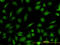 RAB21, Member RAS Oncogene Family antibody, LS-C133697, Lifespan Biosciences, Immunofluorescence image 