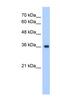Elongation of very long chain fatty acids protein 7 antibody, NBP1-91349, Novus Biologicals, Western Blot image 