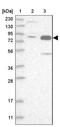 MET Transcriptional Regulator MACC1 antibody, NBP1-89352, Novus Biologicals, Western Blot image 