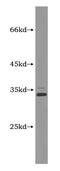 Hes Related Family BHLH Transcription Factor With YRPW Motif 1 antibody, MBS2525913, MyBioSource, Western Blot image 