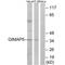 GTPase IMAP family member 5 antibody, A07653, Boster Biological Technology, Western Blot image 