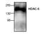 Histone Deacetylase 6 antibody, AP00275PU-N, Origene, Western Blot image 