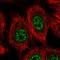 Vacuolar Protein Sorting 72 Homolog antibody, HPA065709, Atlas Antibodies, Immunofluorescence image 