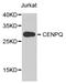 Centromere protein Q antibody, STJ29765, St John