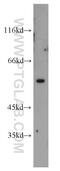 Vimentin antibody, 22031-1-AP, Proteintech Group, Western Blot image 