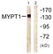 Protein Phosphatase 1 Regulatory Subunit 12A antibody, LS-C117671, Lifespan Biosciences, Western Blot image 