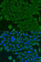BCS1 Homolog, Ubiquinol-Cytochrome C Reductase Complex Chaperone antibody, 23-078, ProSci, Immunofluorescence image 