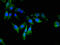 Eukaryotic Elongation Factor 2 Kinase antibody, A62458-100, Epigentek, Immunofluorescence image 