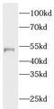 Nucleolar And Spindle Associated Protein 1 antibody, FNab05938, FineTest, Western Blot image 