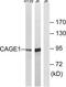 Cancer Antigen 1 antibody, TA316327, Origene, Western Blot image 