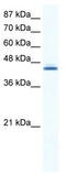 ALX Homeobox 4 antibody, TA341711, Origene, Western Blot image 